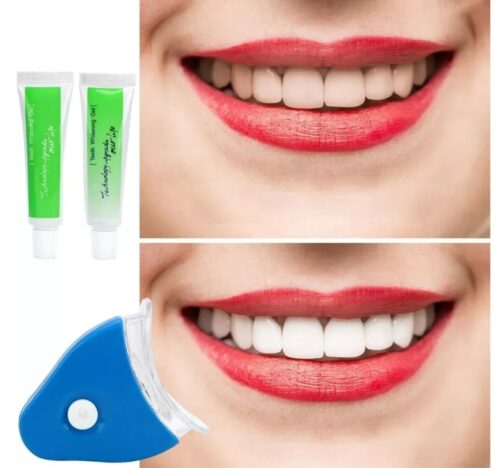 Captura de pantalla 2026-03-13 155216 Blanqueador Dental Gel Tratamiento Whiteline Led Potente En Casa Alta Calidad