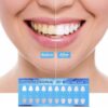 Captura de pantalla 2026-03-13 155253 Blanqueador Dental Gel Tratamiento Whiteline Led Potente En Casa Alta Calidad