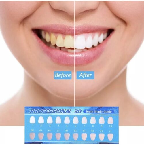 Captura de pantalla 2026-03-13 155253 Blanqueador Dental Gel Tratamiento Whiteline Led Potente En Casa Alta Calidad